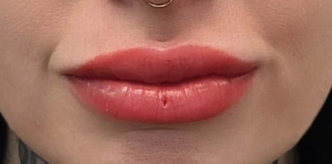 lips after 1