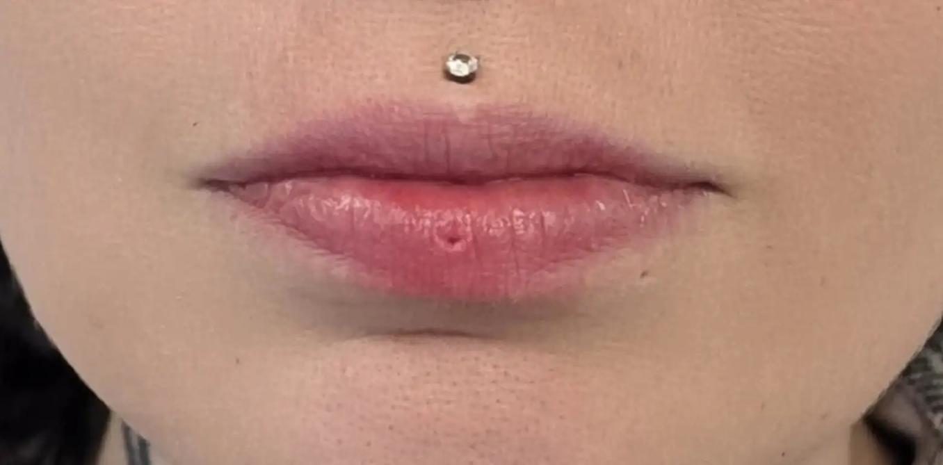 lips before 1 lips before 1